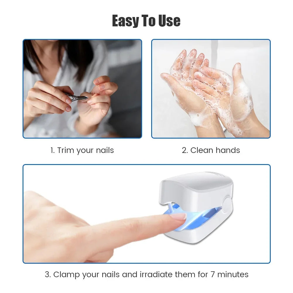 LuxeOrbit Nail Fungus Laser Treatment Device Professional Onychomycosis Therapy Cure Machine for Broken Cracked Split and Weak Nails