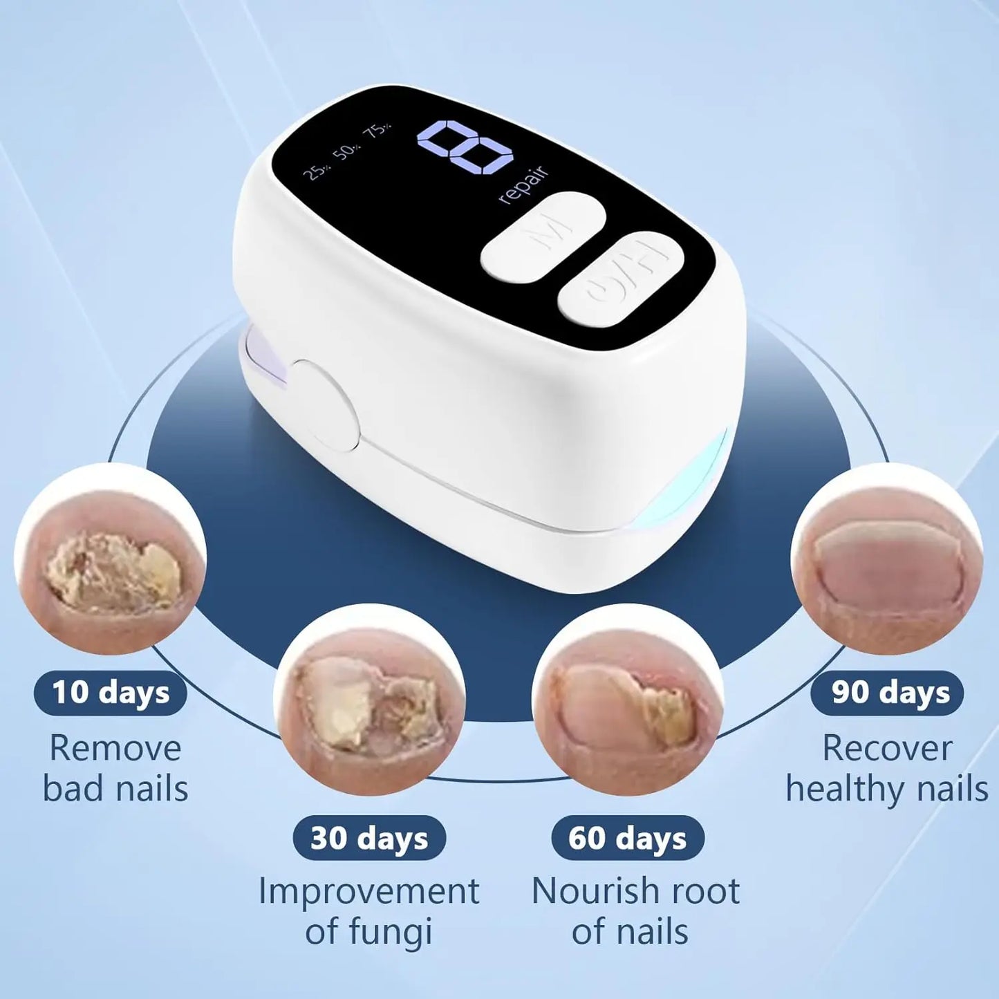 LuxeOrbit 2-in-1 Nail Fungus Laser Device and Nail Art with Time&Battery Display 470+950nm wavelength Anti Fungal Laser Device for Toenail