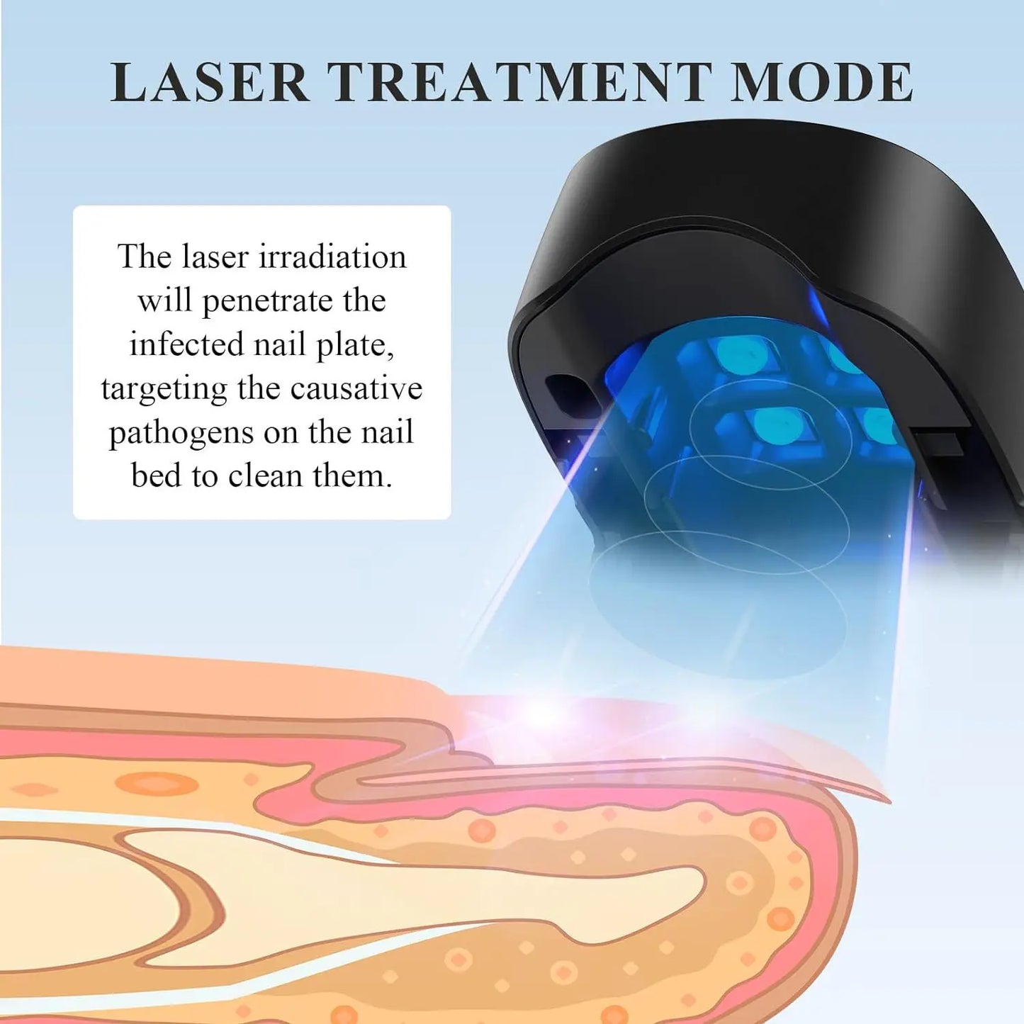 LuxeOrbit Nail Fungus Treatment Laser Device for Cleaning Onychomycosis USB Charge Anti Fungal Repair Damaged Discolored Thick Fingernails