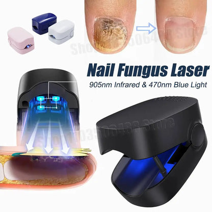 LuxeOrbit Nail Fungus Treatment Laser Device for Cleaning Onychomycosis USB Charge Anti Fungal Repair Damaged Discolored Thick Fingernails