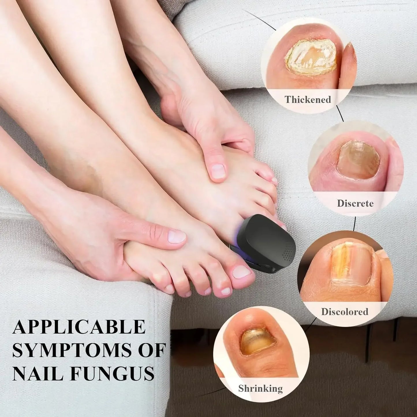 LuxeOrbit Nail Fungus Treatment Laser Device for Cleaning Onychomycosis USB Charge Anti Fungal Repair Damaged Discolored Thick Fingernails