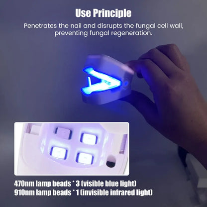 LuxeOrbit Nail Fungus Laser Treatment Device Professional Onychomycosis Therapy Cure Machine for Broken Cracked Split and Weak Nails