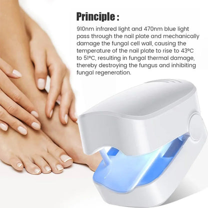 LuxeOrbit Nail Fungus Laser Treatment Device Professional Onychomycosis Therapy Cure Machine for Broken Cracked Split and Weak Nails