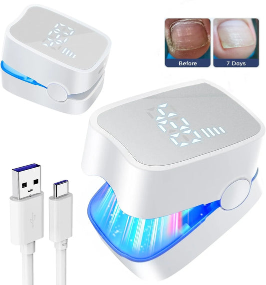 LuxeOrbit Nail Fungus Laser Device with Time Display 470nm950nm wavelength Fast-acting Home Anti Fungal Laser Device for Finger/Toenails