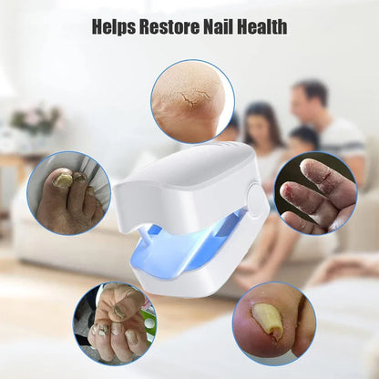 LuxeOrbit Nail Fungus Laser Treatment Device Professional Onychomycosis Therapy Cure Machine for Broken Cracked Split and Weak Nails