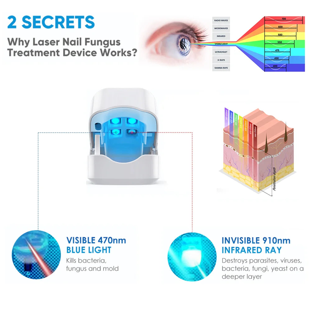 LuxeOrbit Rechargeable Fungus Grey Nail Treatment Device Portable Onychomycosis Treatment Laser Therapy Relieve Ingrown Foot Care