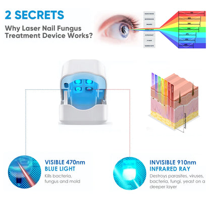 LuxeOrbit Rechargeable Fungus Grey Nail Treatment Device Portable Onychomycosis Treatment Laser Therapy Relieve Ingrown Foot Care