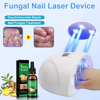 LuxeOrbit Fungal Nail Laser Device Repair Fast Nails Fungus Onychomycosis Repair Toenail Fingernail Removes Nail Fungus Foot Care Device