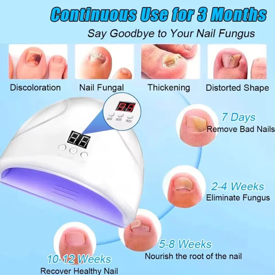 LuxeOrbit Fungal Nail Laser Device Repair Fast Nails Fungus Onychomycosis Repair Toenail Fingernail Removes Nail Fungus Foot Care Device