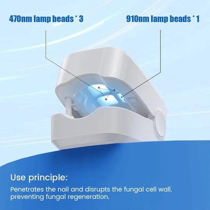 LuxeOrbit Nail Fungus Laser Treatment Device Professional Onychomycosis Therapy Cure Machine for Broken Cracked Split and Weak Nails